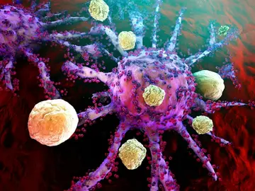 Células cancerígenas Células cancerígenas cáncer