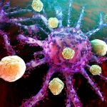 Células cancerígenas