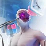 First demonstration of bimanual magnetic soft robots for skull-base surgery