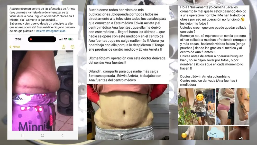 Edwin arrieta, acusado por mala praxis por sus pacientes: "testimonio"