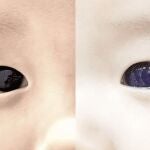 Los ojos de un bebé cambian de color después de recibir un tratamiento contra la Covid-19