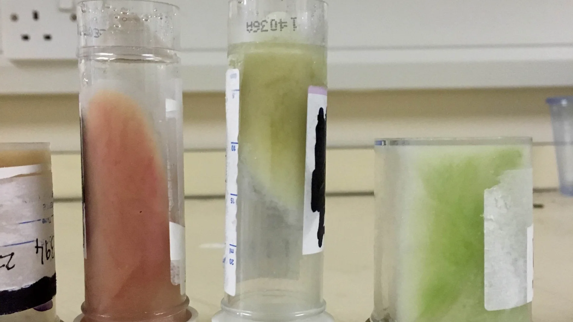 Esputo de diferentes colores utilizado como indicador del grado de inflamación en los pulmones