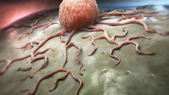 Células cancerígenas