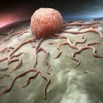 Células cancerígenas