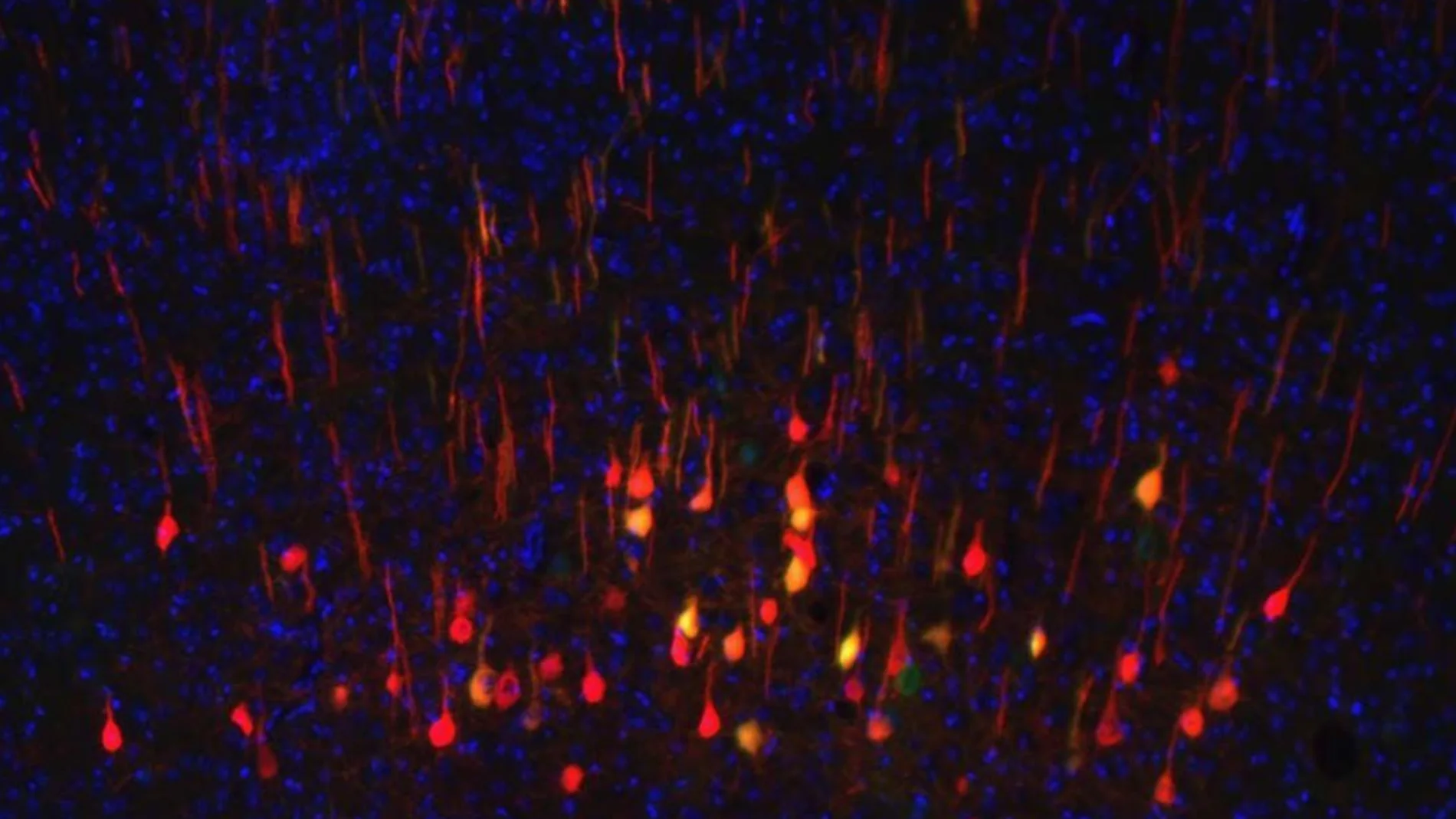 Neuronas