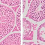Una microscopía muestra el desarrollo normal del espermatozoide (dcha.) y los espacios vación en las formaciones alteradas.