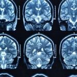 Imagen del cerebro