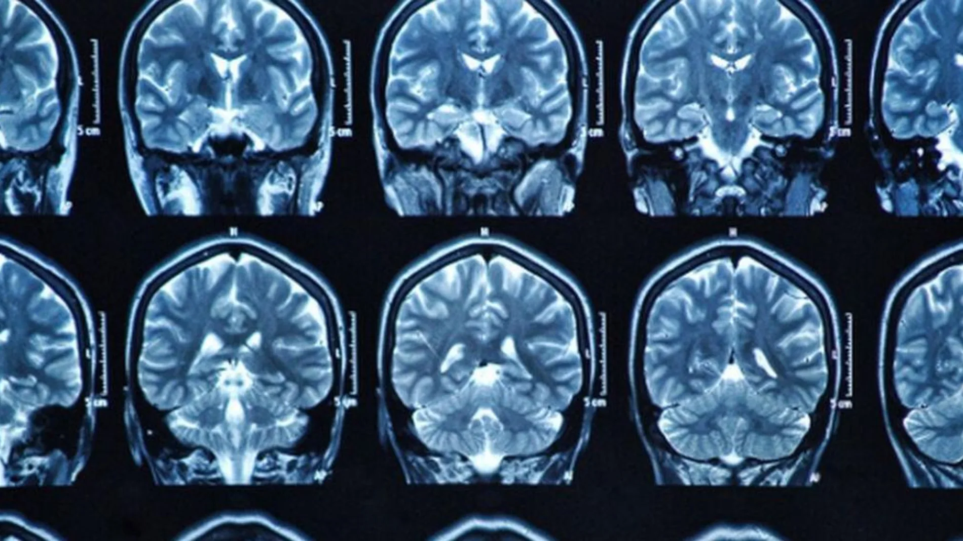 Imagen del cerebro