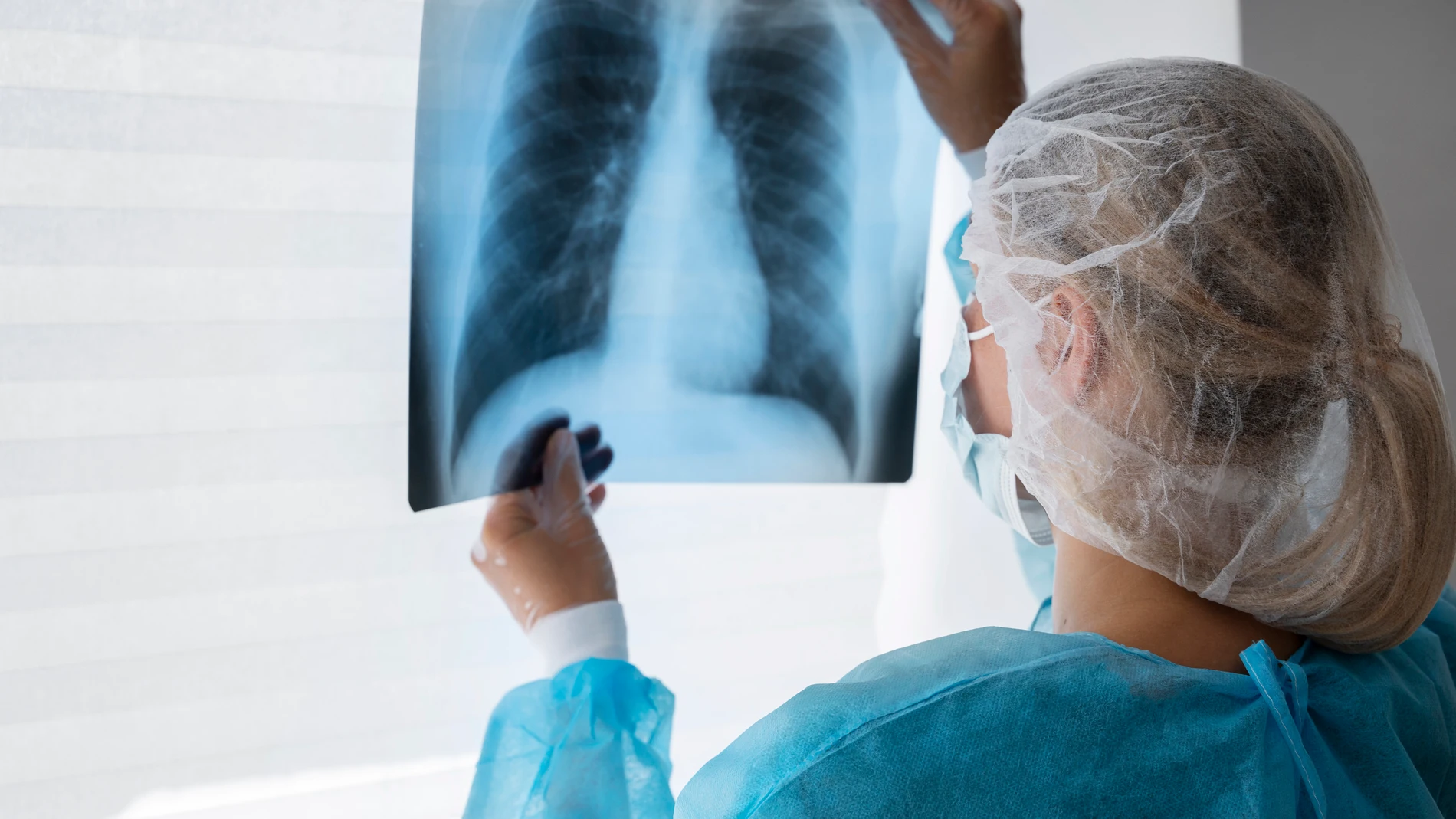 Radiografía de pulmón