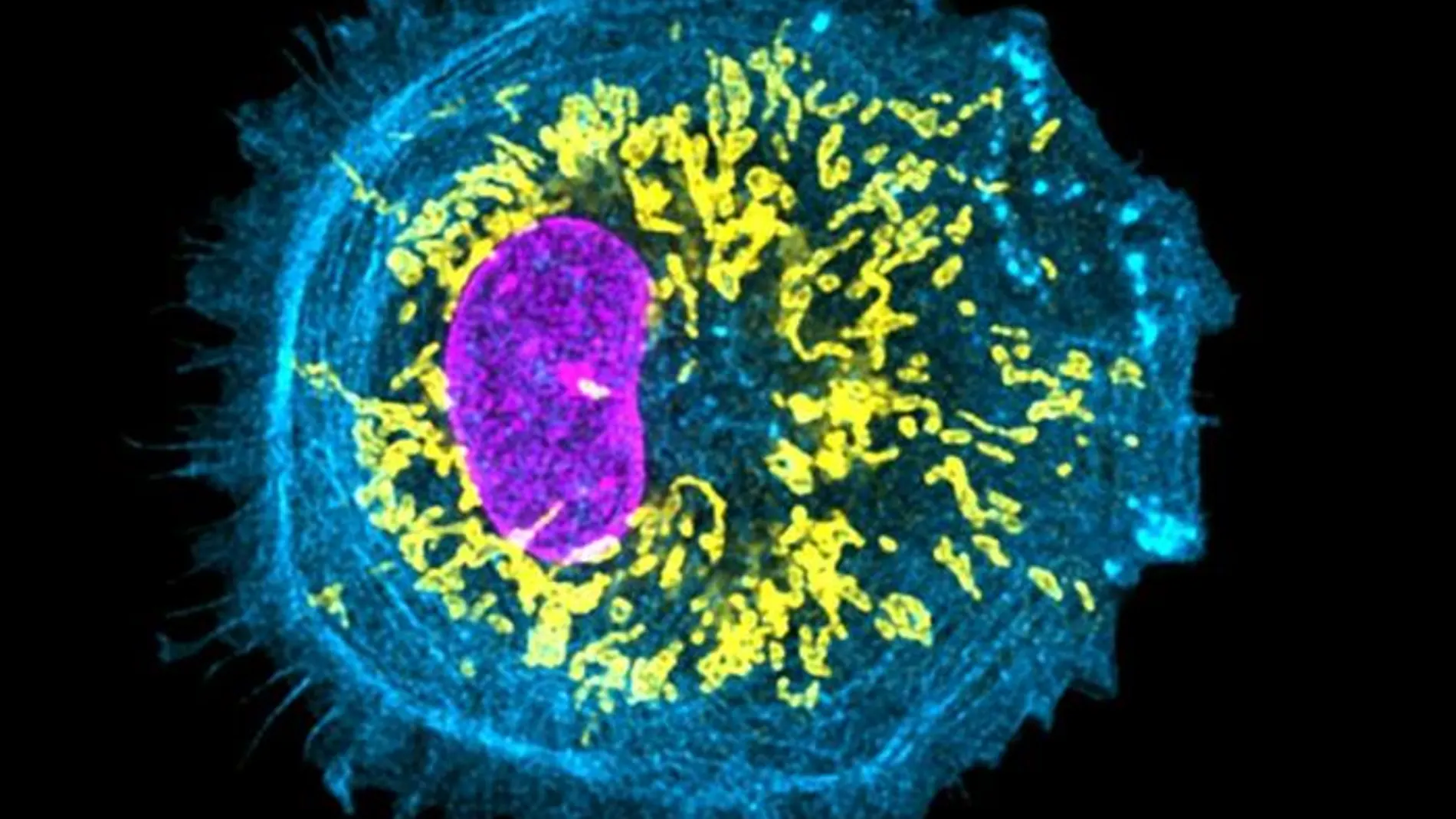 Imagen de microglía cerebral fabricar cerebro alzheimer autismo parkinson