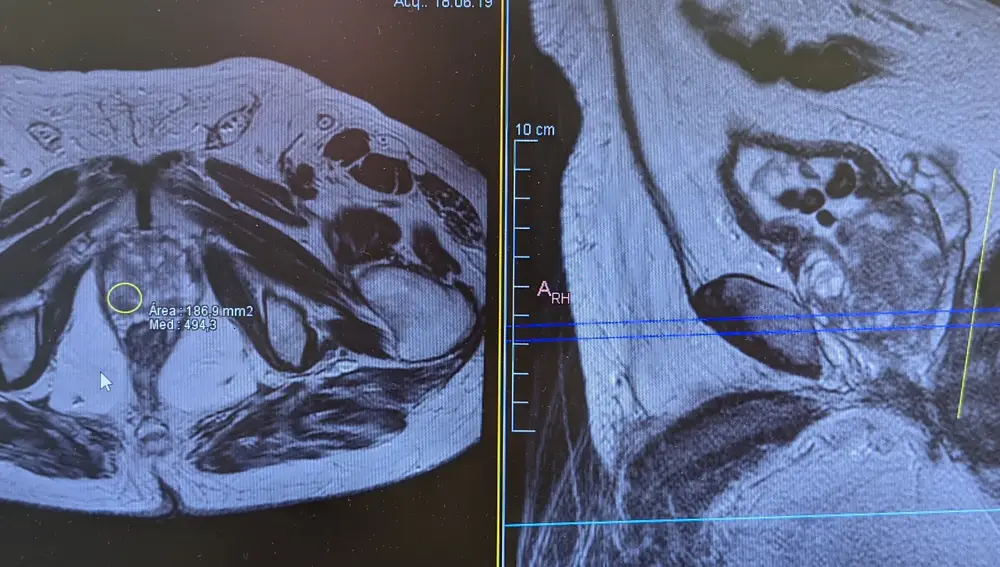 Cirugía en urología