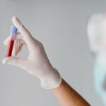 Esperan crear el primer test de sangre en detectar el cáncer de páncreas en estadios tempranos