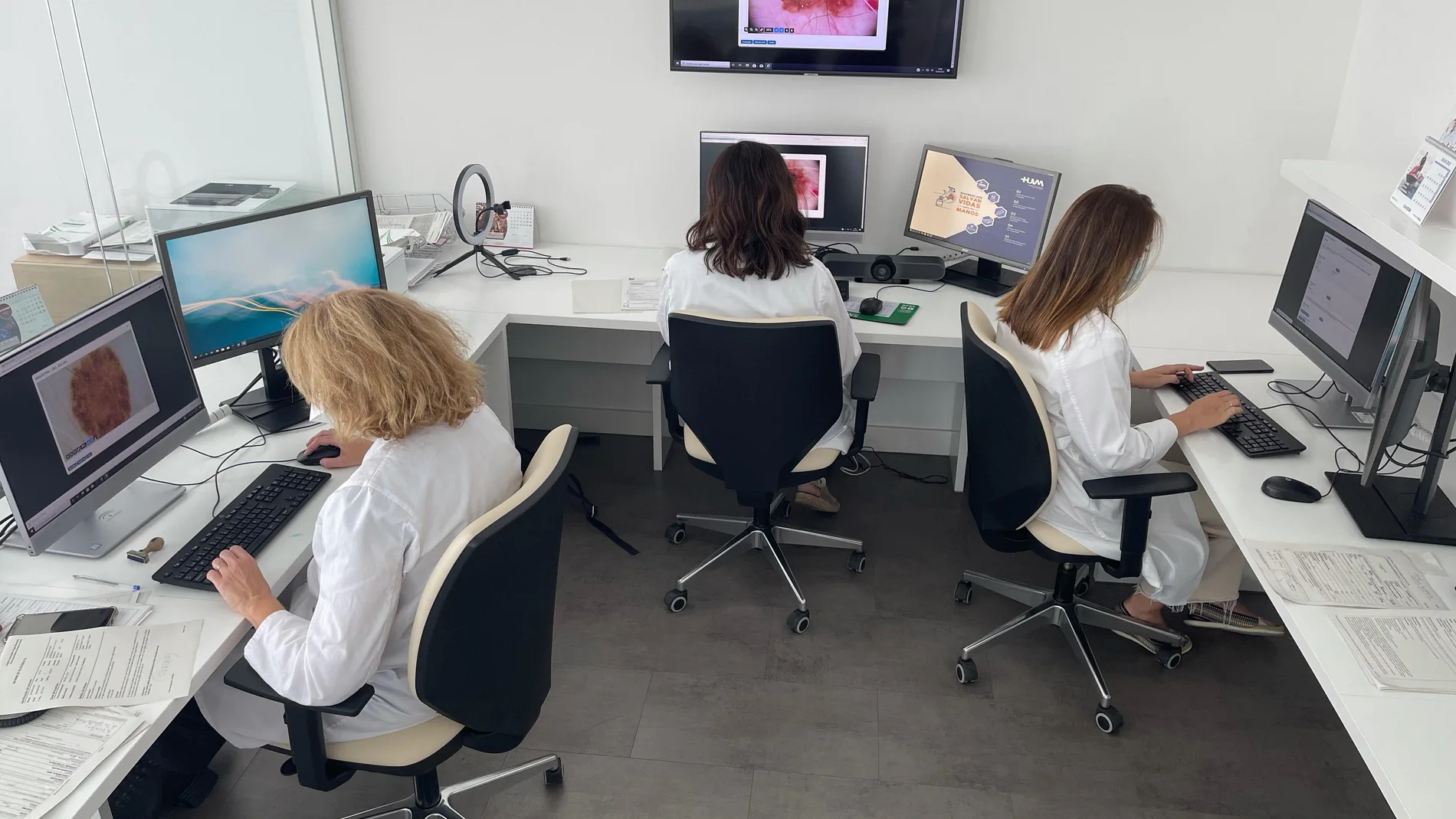 Muchos melanomas se detectan a través de las consultas de teledermatología