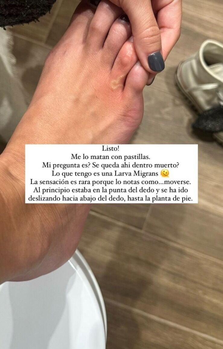 Lucía Pombo muestra la larva que vive en su interior