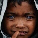 Esta condición genética única se conoce como Síndrome de Waardenburg