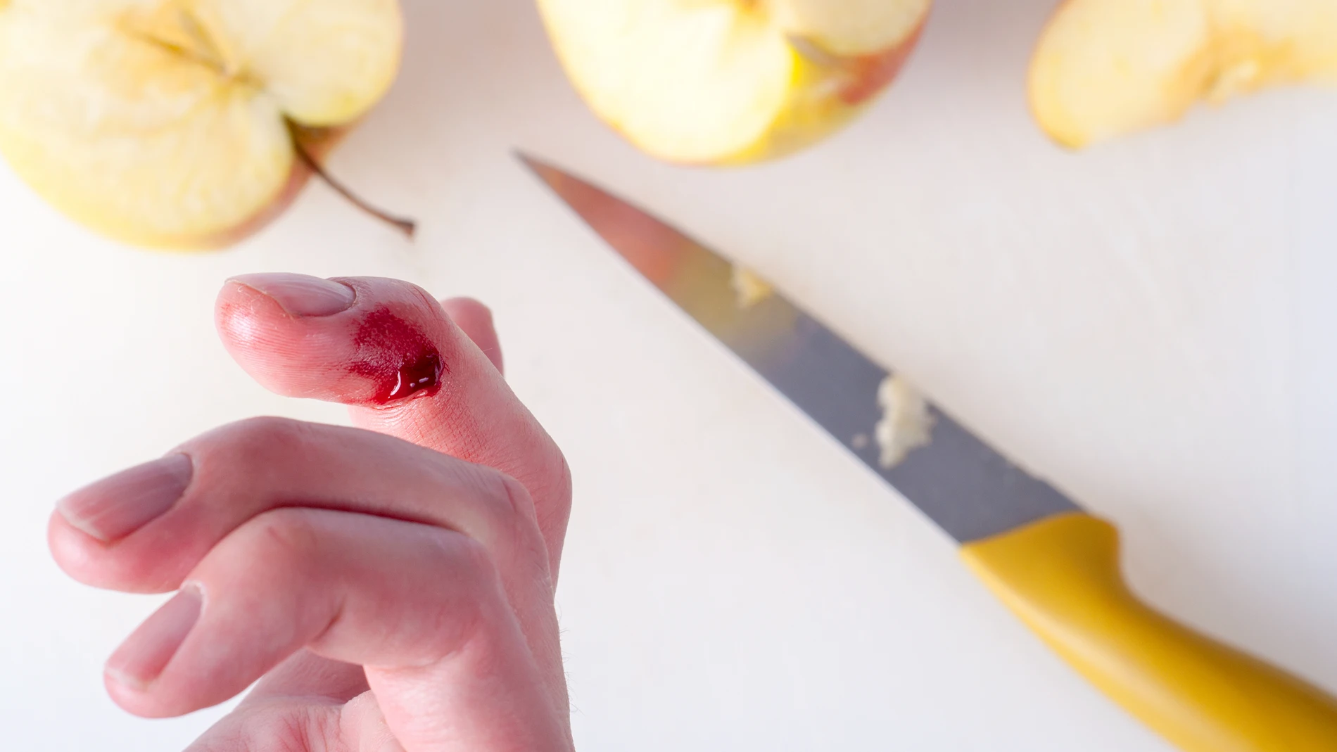 Los accidentes domésticos son más comunes de lo que parecen y un cuchillo puede provocarnos una herida poco gratificante