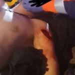 Cuatro dominicanos apuñalan a un vigilante de Desokupa