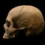 Un estudio vincula las posibles patologías que puede sufrir una persona a través de la morfología de sucerebro