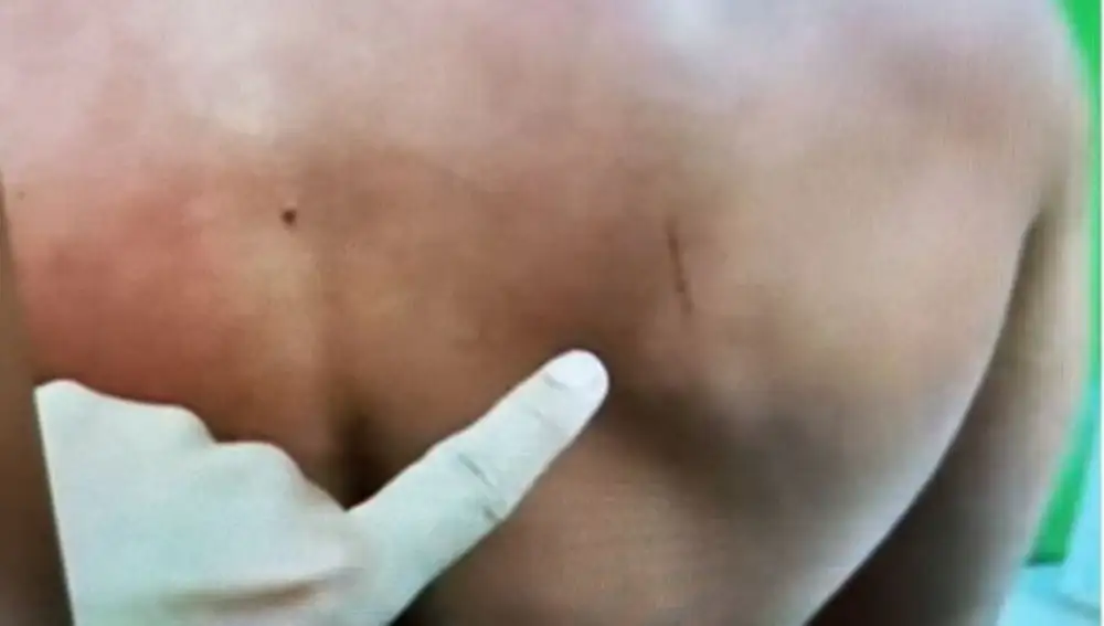 Fotografía del caso de Daniel Sancho, el español encarcelado en Tailandia acusado de asesinar y descuartizar a principios de agosto a un hombre colombiano en ese país asiático
