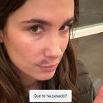 María Pombo aparece con la cara magullada y explica qué le ha pasado