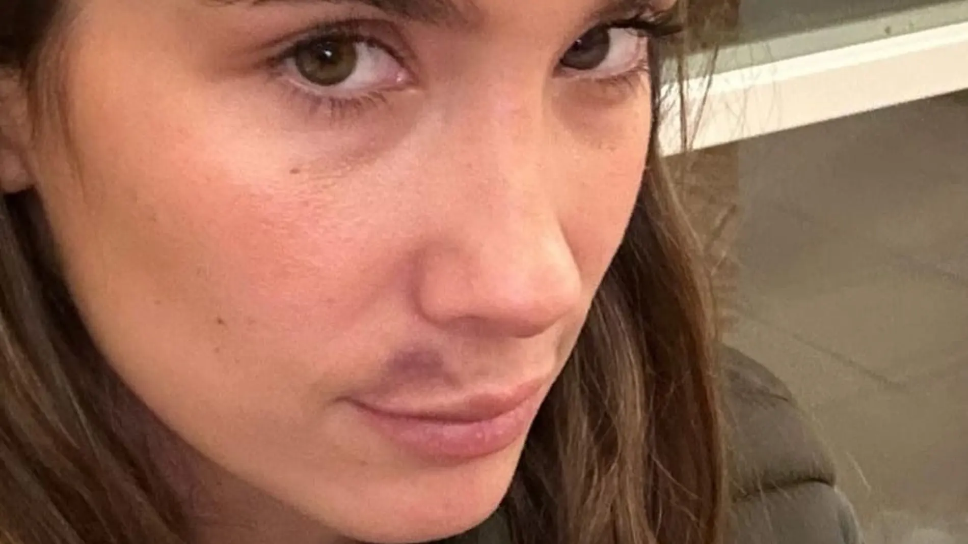 María Pombo aparece con la cara magullada y explica qué le ha pasado