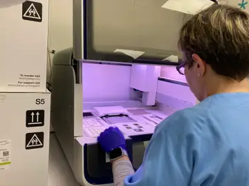 El cribaje en cáncer de colon es clave para una detección precoz y, por lo tanto, para el pronóstico del paciente El cribaje en cáncer de colon es clave para una detección precoz y, por lo tanto, para el pronóstico del paciente