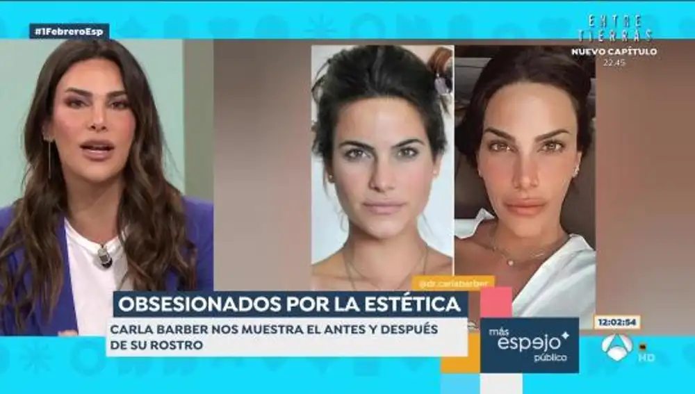 Carla Barber mostrando el antes y el después de su rostro