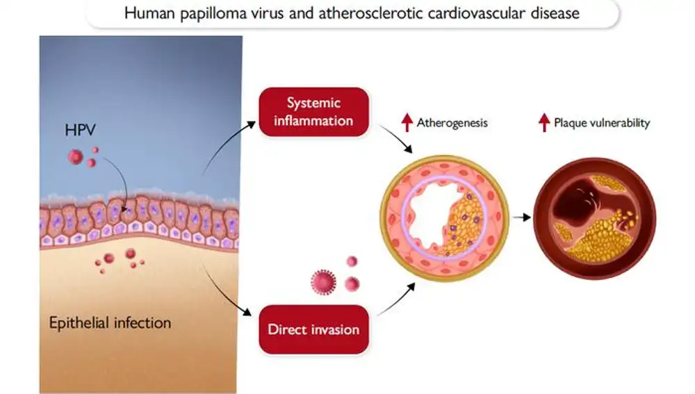 Ilustración que acompaña al estudio sobre VPH y enfermedades cardiovasculares