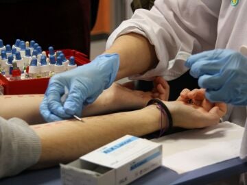 Un sanitario realiza una prueba de alergia a una paciente 