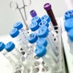 muestras de sangre