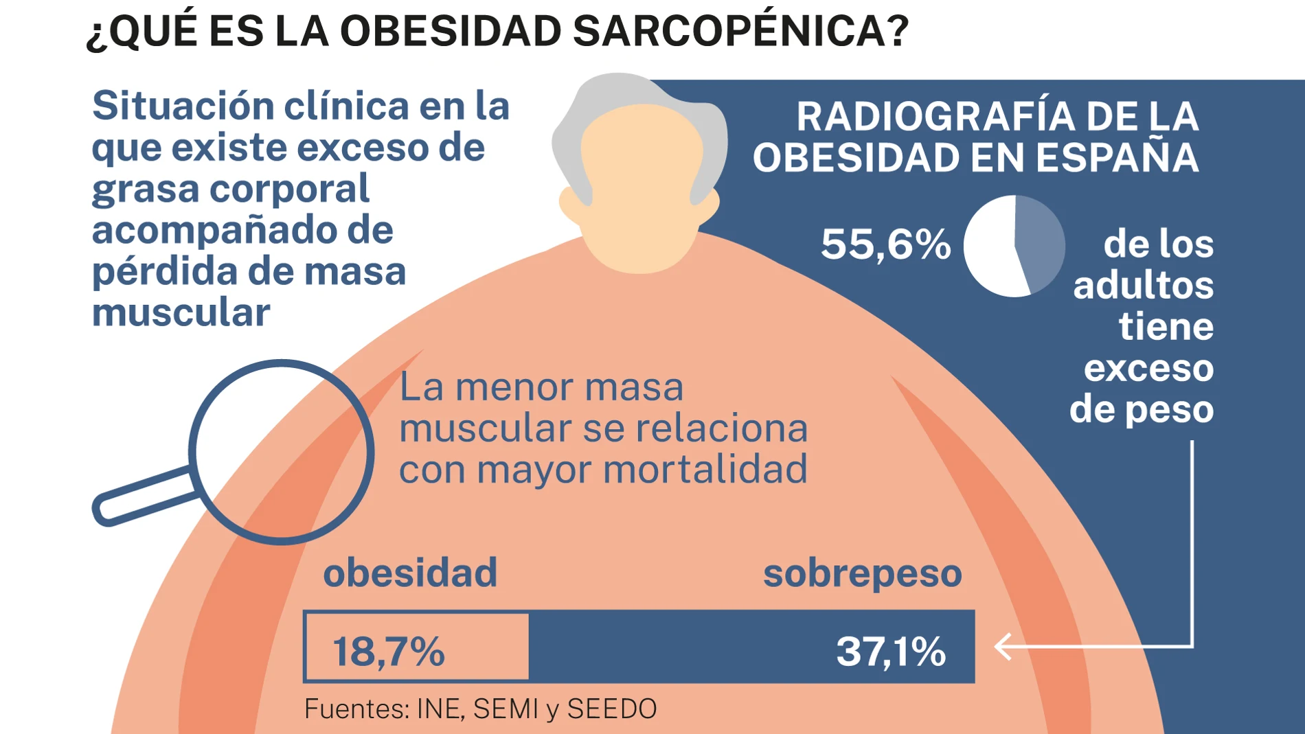 Obesidad sarcopénica