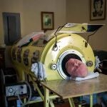 Paul Alexander, el hombre que pasó más de 70 años en un pulmón de acero por la polio