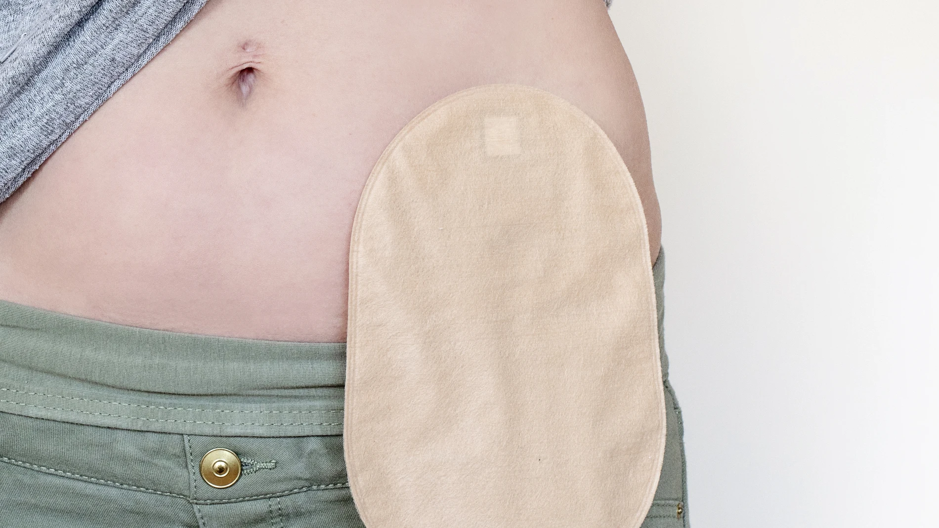 Ostomía