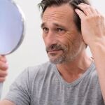 Tratamientos para la alopecia