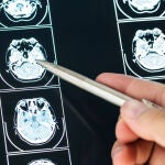Radiografía del cerebro