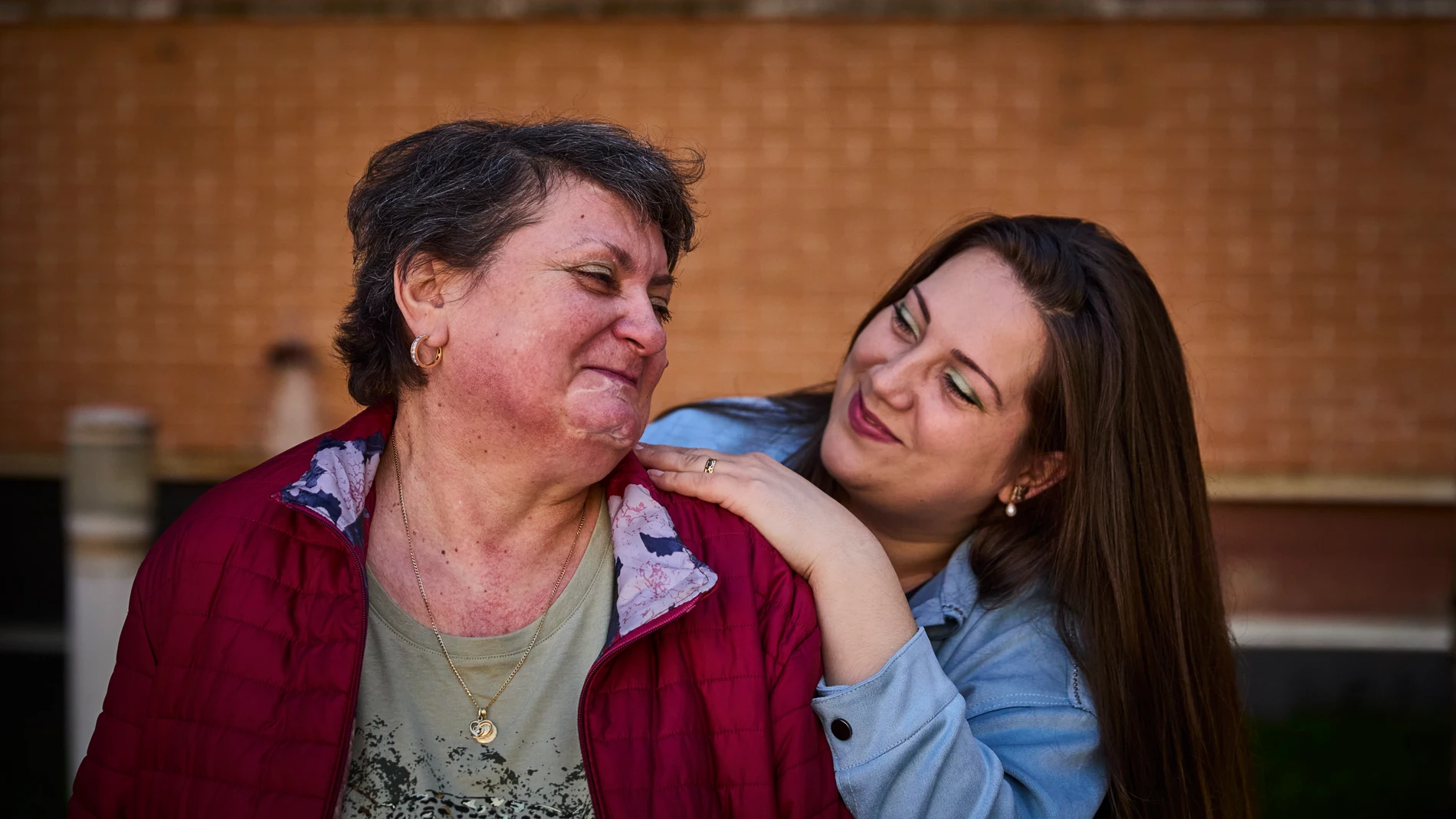 Mariana Moisa, con síndrome de Cushing, y su hija Irina