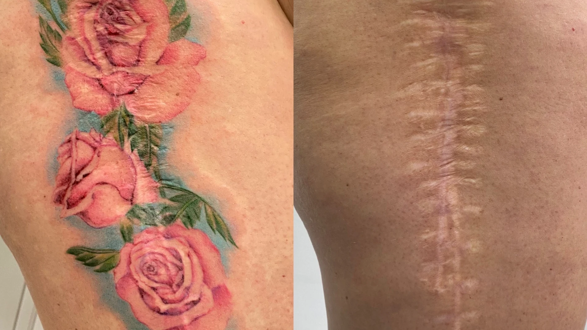 El tatuaje genera un vínculo emocional con la persona