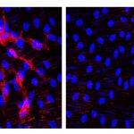 Identifican las células clave para prevenir la aterosclerosis en el síndrome de progeria