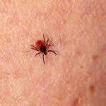 Salud lanza recomendaciones para prevenir la Enfermedad de Lyme, que se transmite por la picadura de garrapatas