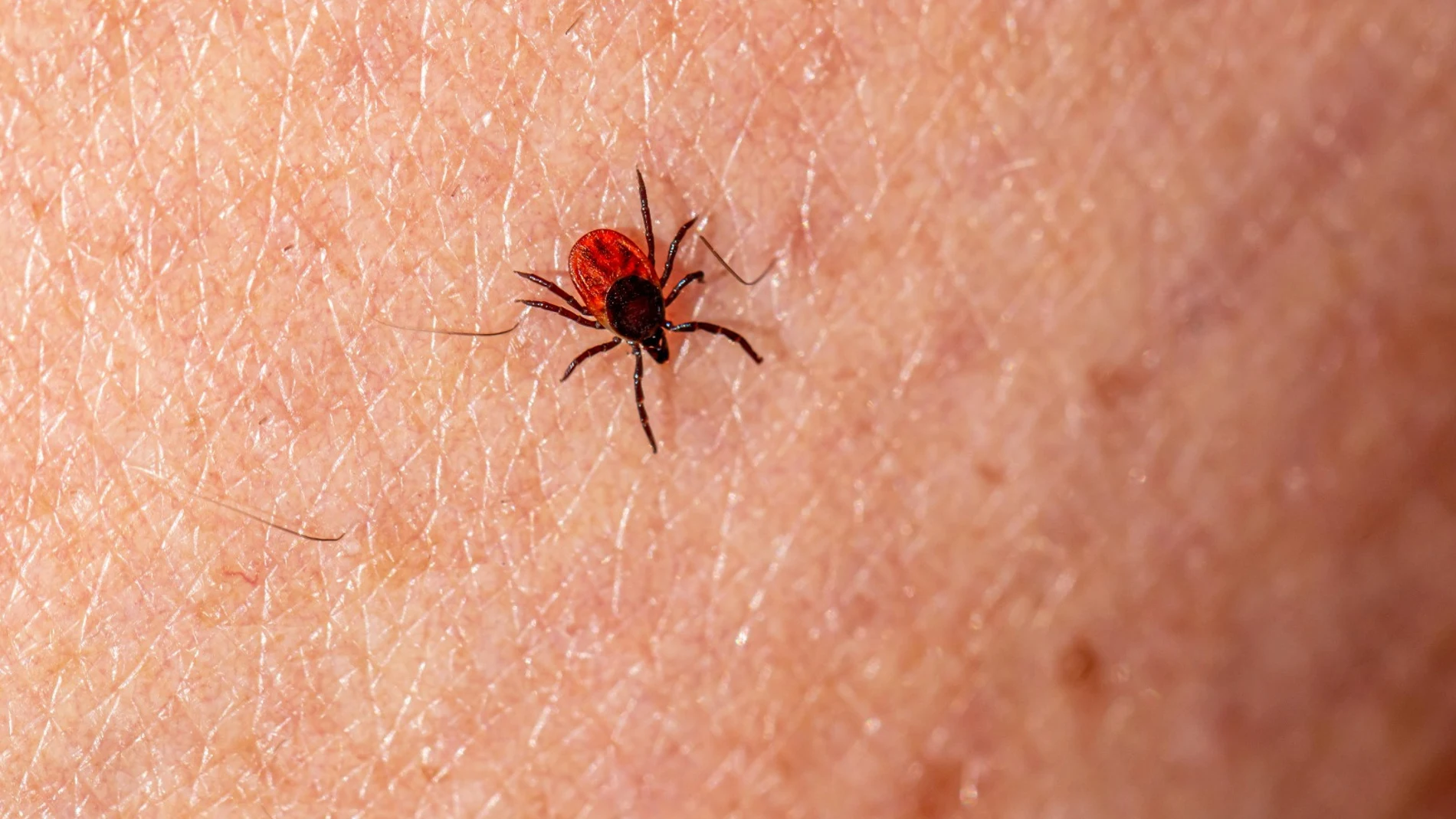 Salud lanza recomendaciones para prevenir la Enfermedad de Lyme, que se transmite por la picadura de garrapatas