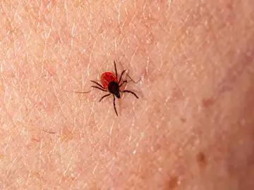 La Enfermedad de Lyme se produce por una bacteria transmitida por la picadura de garrapatas infectadas La Enfermedad de Lyme se produce por una bacteria transmitida por la picadura de garrapatas infectadas