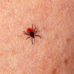 La Enfermedad de Lyme se produce por una bacteria transmitida por la picadura de garrapatas infectadas