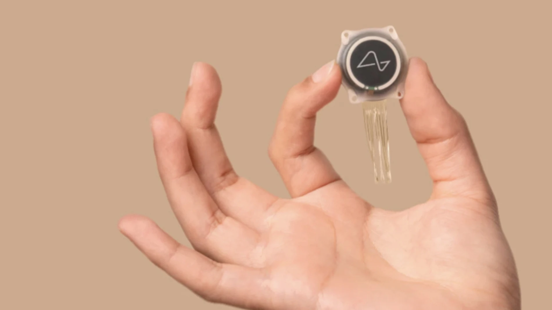 El primer chip de Neuralink implantado en el cerebro de un humano comienza a desprenderse.