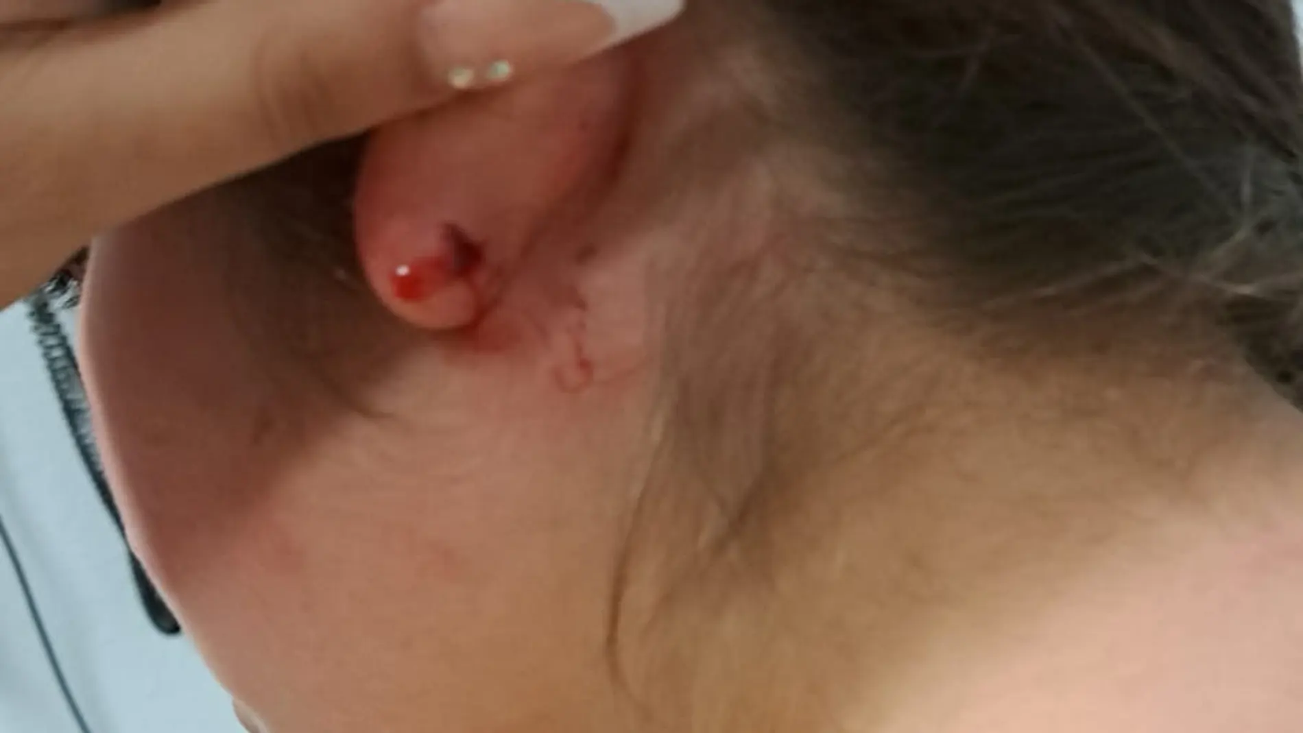 Algunas heridas sufridas por la víctima