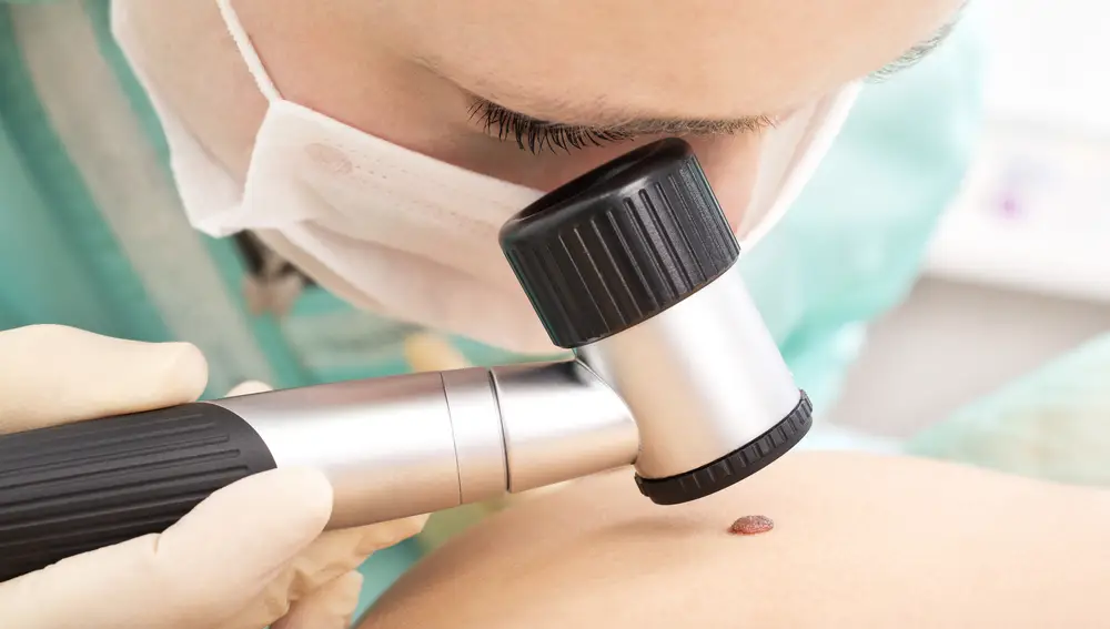 Dermatología es la especialidad que registra una mayor espera en España, tan solo por detrás de Neurología