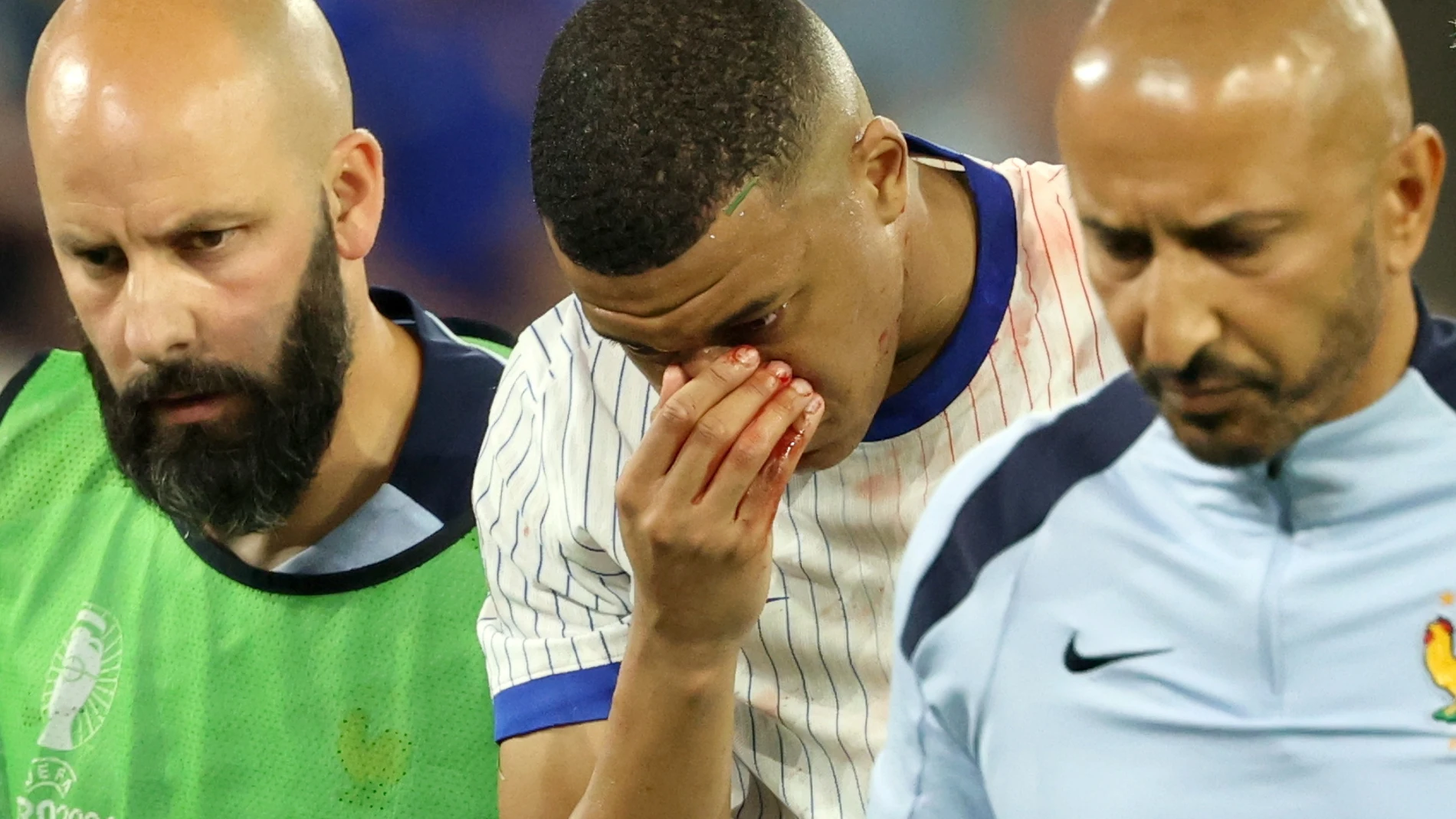 Mbappé, en el momento de su retirada del campo en el partido ante Austria