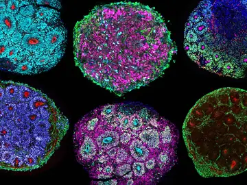 Cerebros creados con células de cinco personas distintas. Cerebro