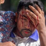Clash between quota protesters and Chhatra League in Dhaka