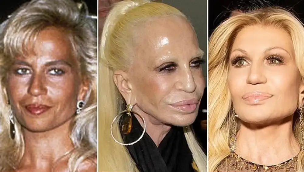 Antes y después de Donatella Versace