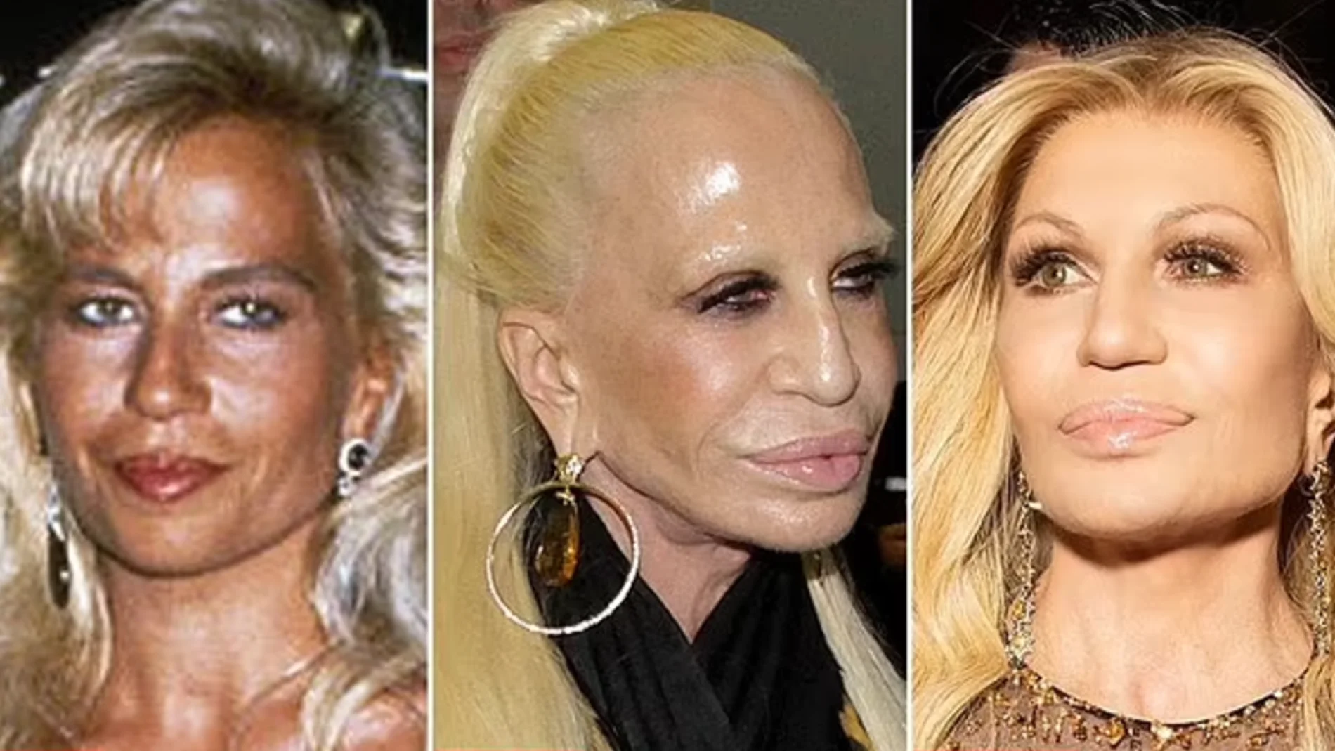 Antes y después de Donatella Versace